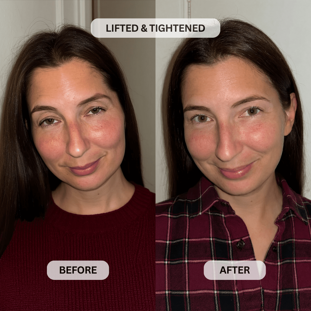Botanique Paris customer before and after photo showing hooded upper eyelids looking visibly lifted