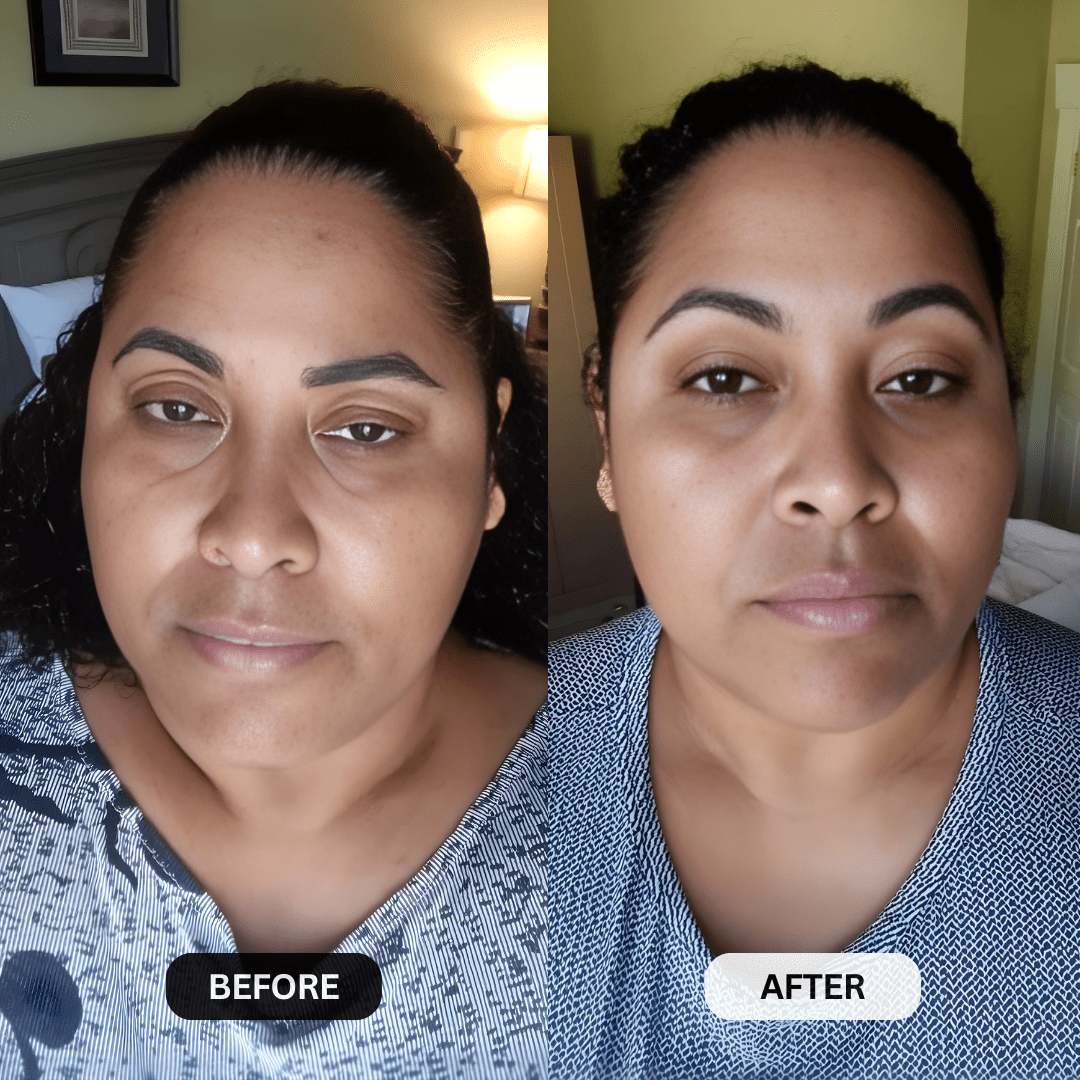 Botanique Paris customer before and after photo showing hooded upper eyelids looking visibly lifted