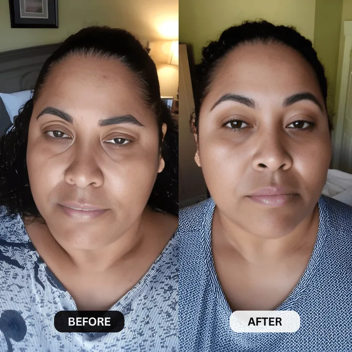 Botanique Paris customer before and after photo showing hooded upper eyelids looking visibly lifted